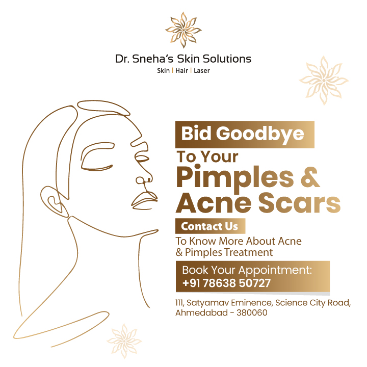 Social media post design for Dr. Sneha's Skin Solutions acne treatment promotion