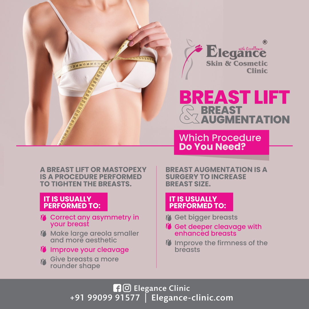 Social media informational post design for Elegance Clinic on breast lift and augmentation procedures